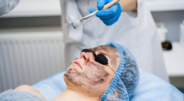 pngtree-dermatologist-applies-black-mask-for-laser-treatment-rejuvenation-peeling-dermatology-photo-image_45827640